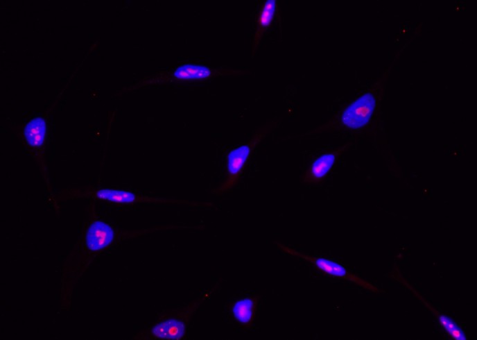 Recombinant ABHD14B Monoclonal Antibody-searchlist-1