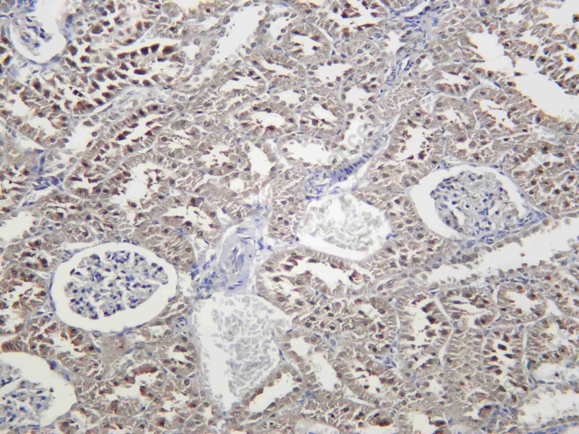 Recombinant Skp1 Monoclonal Antibody - 2
