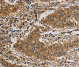 CASP3 Polyclonal Antibody - 2