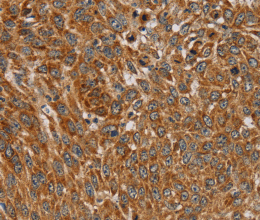 PLEKHG6 Polyclonal Antibody - 2