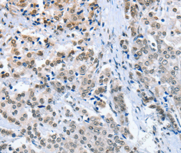 ELAVL1 Polyclonal Antibody - 3