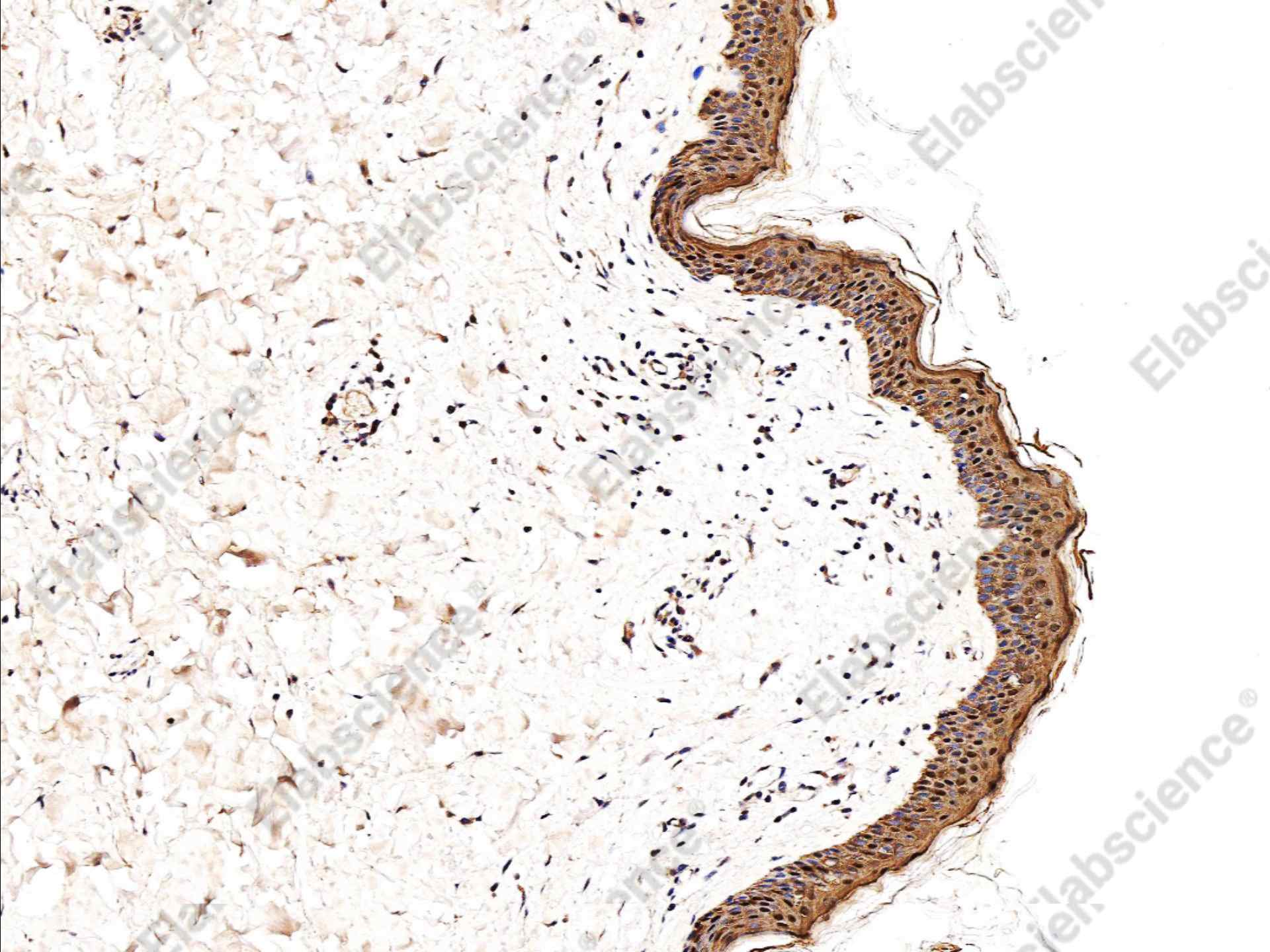 Recombinant Caspase-14/CASP14 Monoclonal Antibody - 1