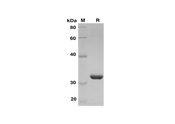 Recombinant Human CD33 Protein(His Tag)-产品推荐-1