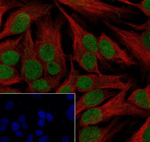 Recombinant CHD3 Monoclonal Antibody - small - 3