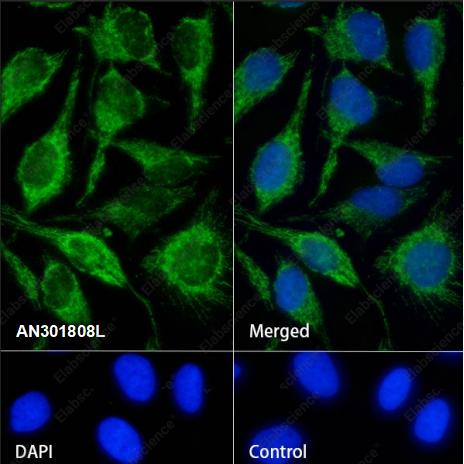 Recombinant PDHA1 Monoclonal Antibody - 2