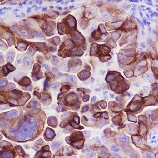 Recombinant MUC4 Monoclonal Antibody - 2
