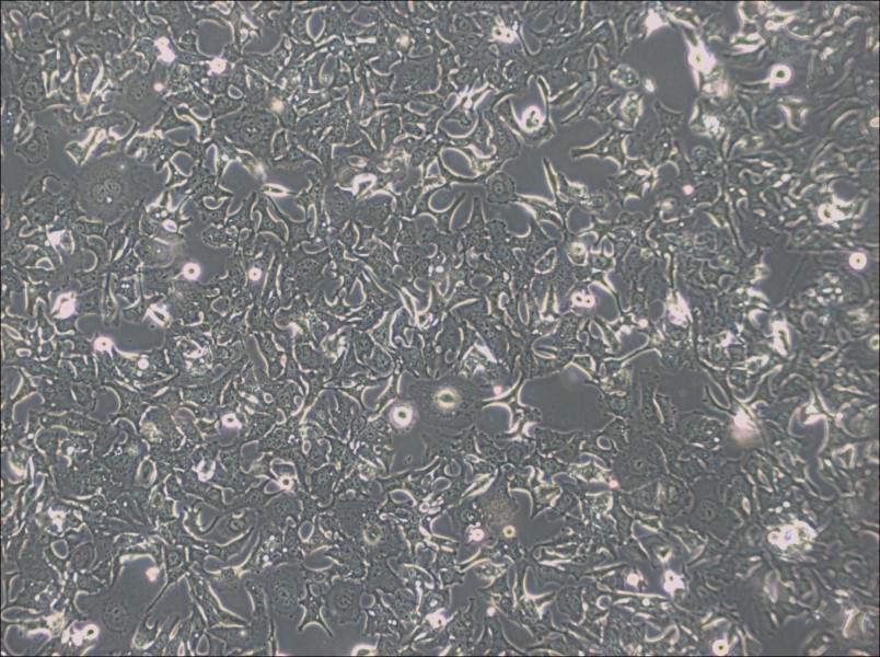 HCC1954 Cell Complete MediumHCC1954 Cell Complete Medium - 2