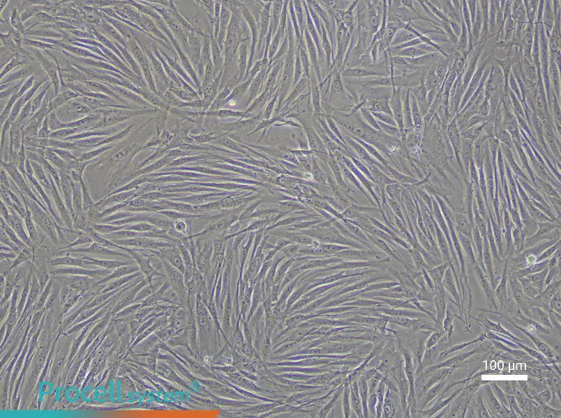 Human Umbilical Vein Smooth Muscle Cell Complete Medium - 1