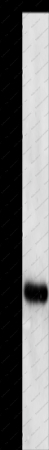 PCNA Polyclonal Antibody - 1