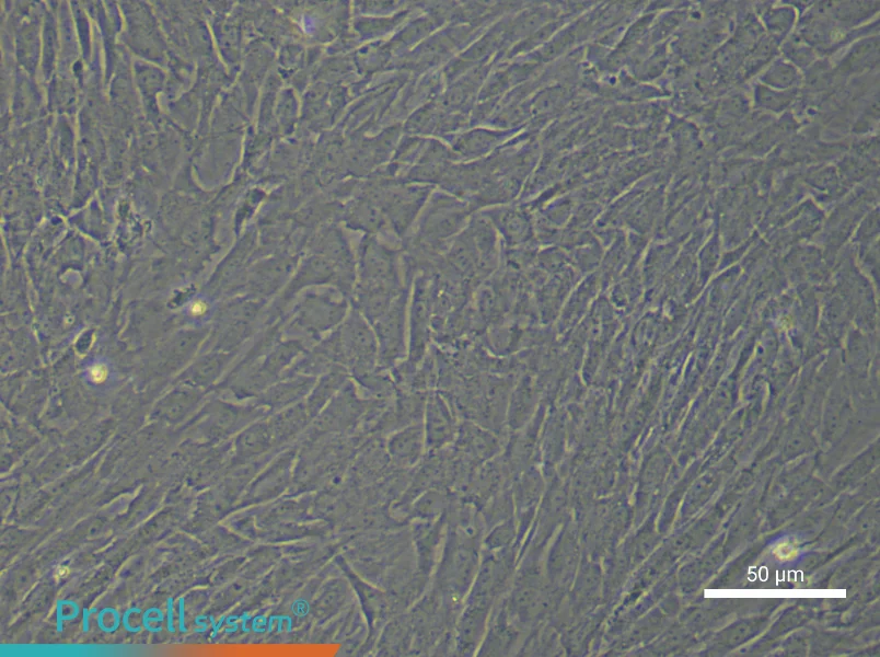 Human Gastric Cancer Fibroblast Complete Medium - 5