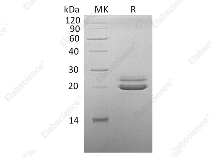 Recombinant Cynomolgus FGF-21/Fibroblast Growth Factor 21 Protein (His Tag) - 1