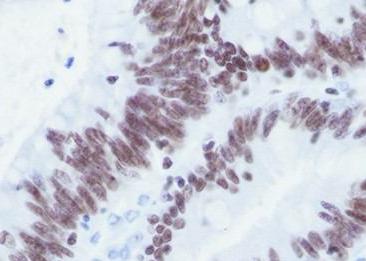 Recombinant SMARCC2/BAF170 Monoclonal Antibody-searchlist-2