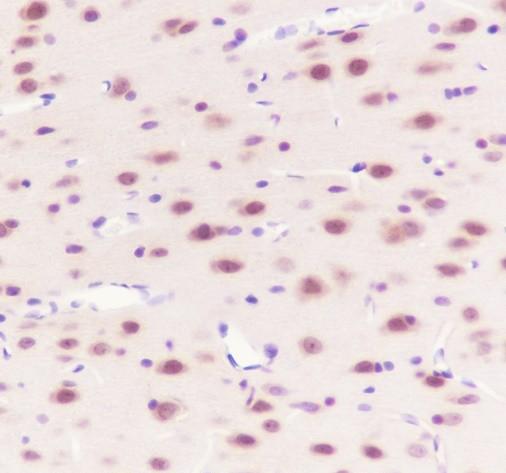 Recombinant Casein Kinase 2 beta Monoclonal Antibody - 3