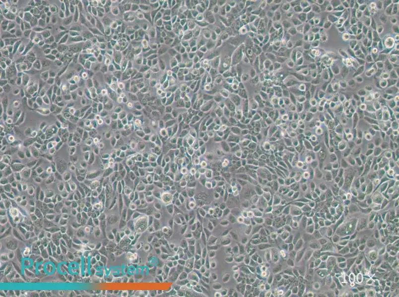 VK2/E6E7 Cell Complete Medium - 1