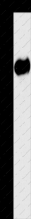 AMY2A Polyclonal Antibody - 1