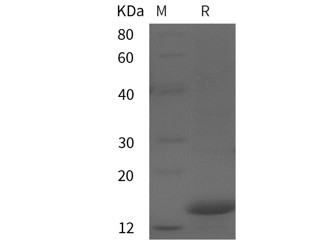 Recombinant Mouse GM-CSF Protein(His Tag)-1
