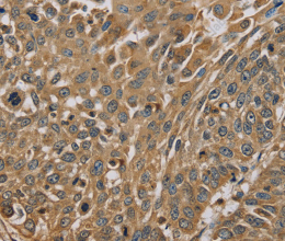 MYL3 Polyclonal Antibody - 2
