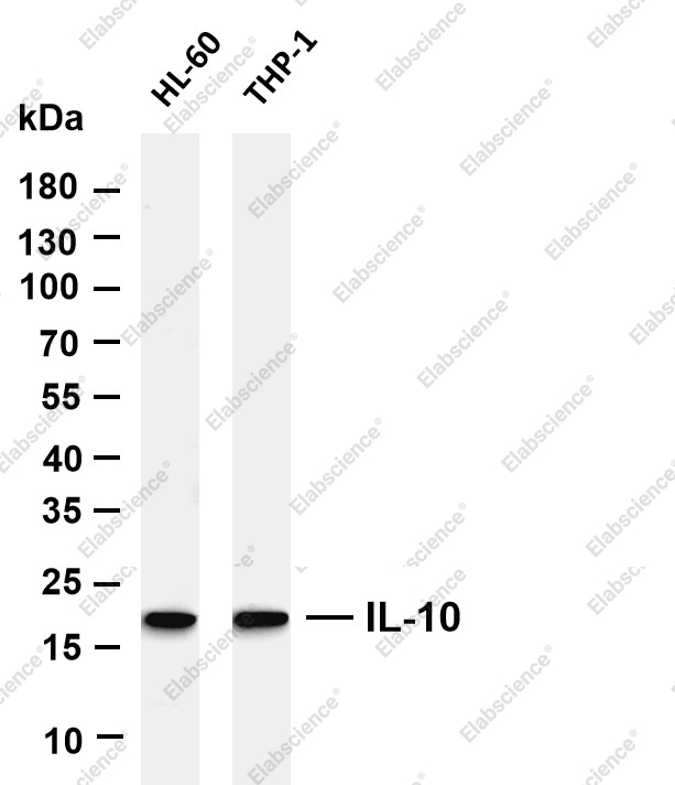 Recombinant IL-10 Monoclonal Antibody - 2