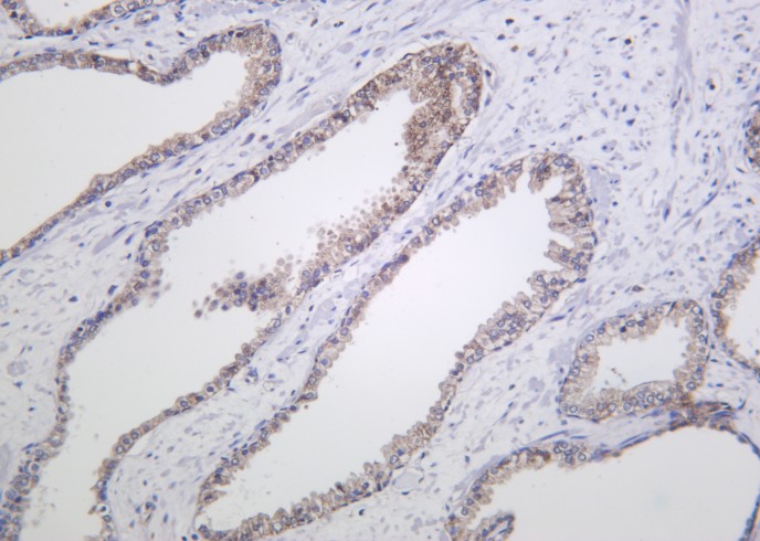 Recombinant Raf-B Monoclonal Antibody-searchlist-1