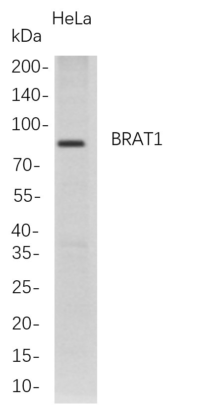 Recombinant BRAT1 Monoclonal Antibody-searchlist-1
