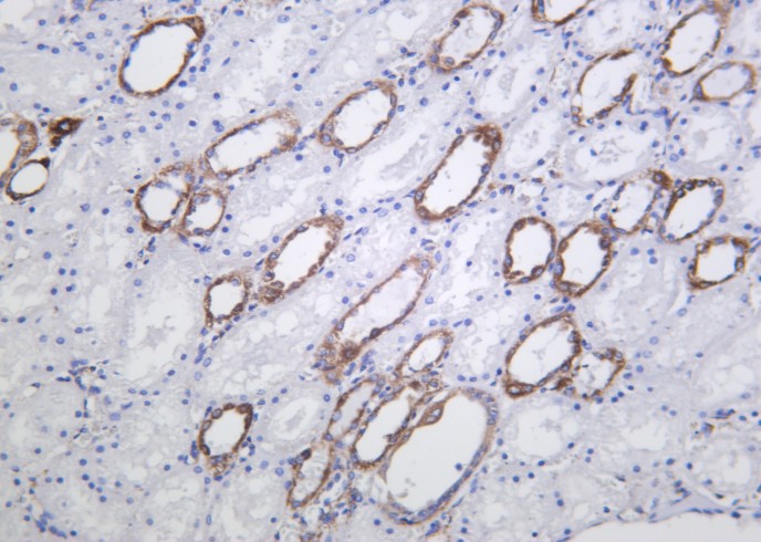 Recombinant HXK I Monoclonal Antibody-searchlist-1