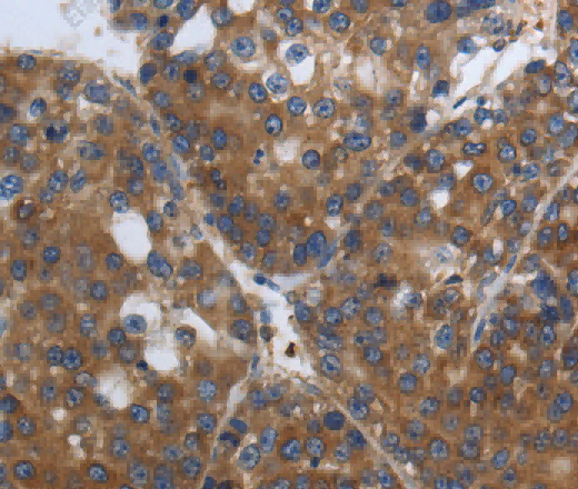 SOCS1 Polyclonal Antibody - 2