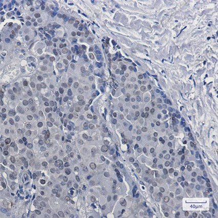 Recombinant DKC1 Monoclonal Antibody - 4