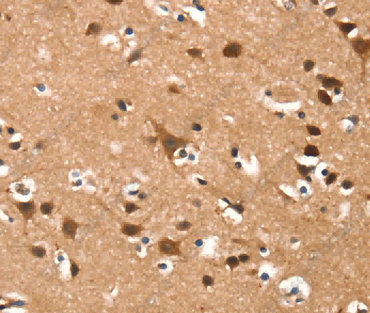 DAAM1 Polyclonal Antibody - 3