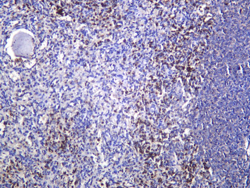 Recombinant CD27/TNFRSF7 Monoclonal Antibody - 2