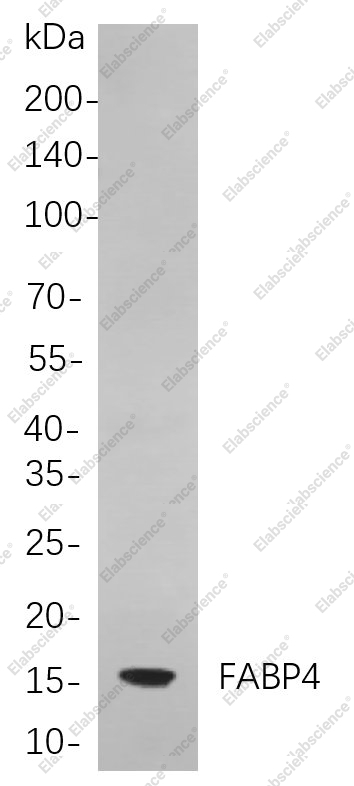 Recombinant FABP4 Monoclonal Antibody - 1