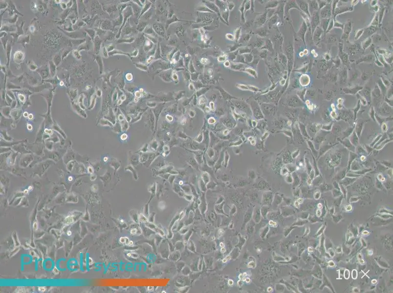 Anglne Cell Complete Medium - 1