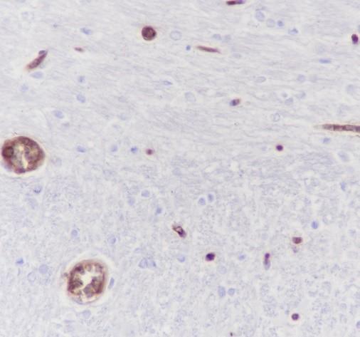 Recombinant Hemoglobin Alpha Monoclonal Antibody - small - 4