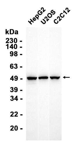 Recombinant Angiotensinogen/AGT Monoclonal Antibody - 2