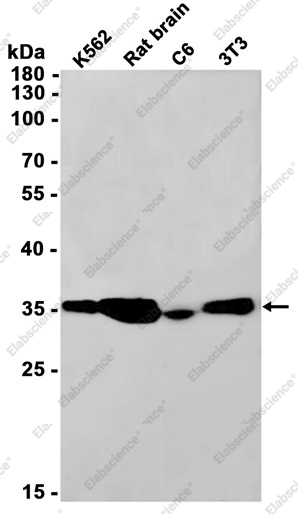 Recombinant PP2A alpha/beta Monoclonal Antibody - 1