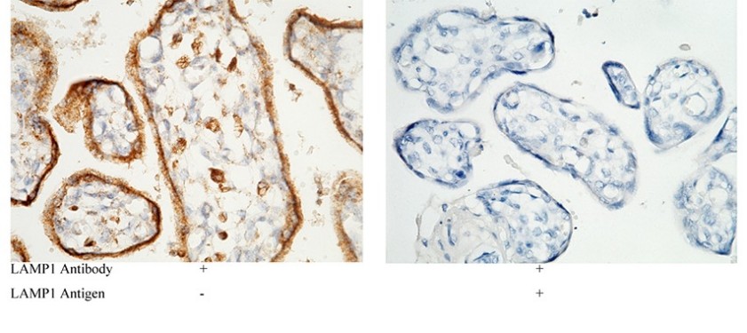Recombinant LAMP1/CD107a Monoclonal Antibody - small - 3