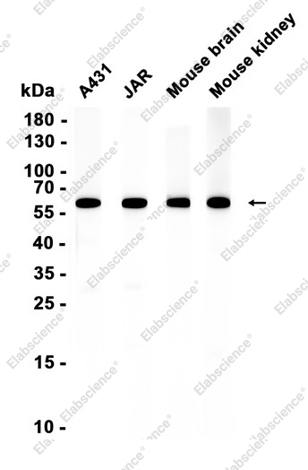 Recombinant FAAH Monoclonal Antibody - 1