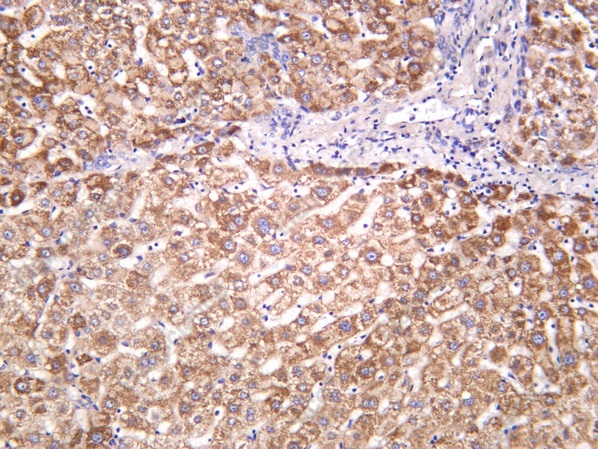 Recombinant PEPCK Monoclonal Antibody - 2