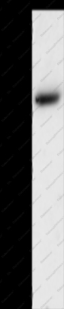 AKR1B1 Polyclonal Antibody - 1