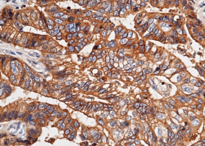 Recombinant E-Cadherin/CDH1/E-cad/CD324 Monoclonal Antibody - small - 3