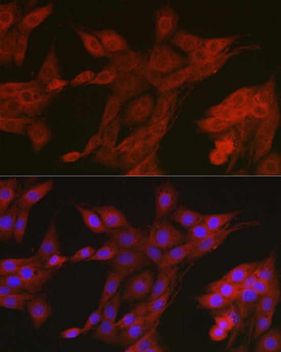 Immunofluorescence analysis of PC-12 cells using AMPKα2 Polyclonal Antibody at dilution of 1:100 (40x lens). Blue:DAPI for nuclear staining.