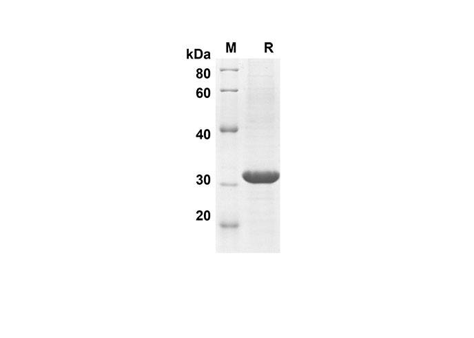 Recombinant Human G-CSF Protein(Trx Tag)-产品推荐-1