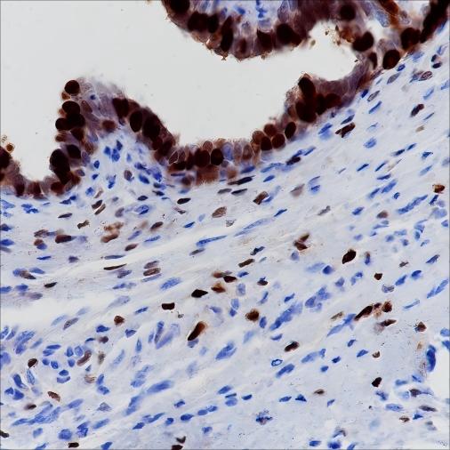 Recombinant Progesterone Receptor Monoclonal Antibody - 2