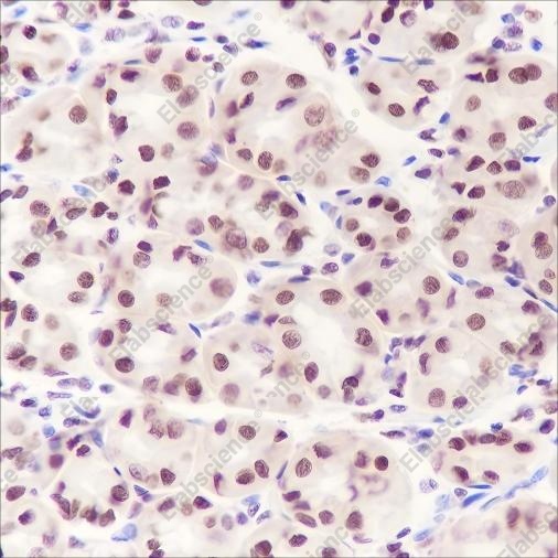 Recombinant DNMT1 Monoclonal Antibody - 2