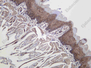 Recombinant TOMM70 Monoclonal Antibody - 3
