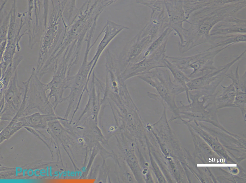 Human Synovial Fibroblast (rheumatoid arthritis) Complete Medium - 6