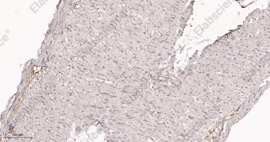 Recombinant Cyclin E1 Monoclonal Antibody - 3