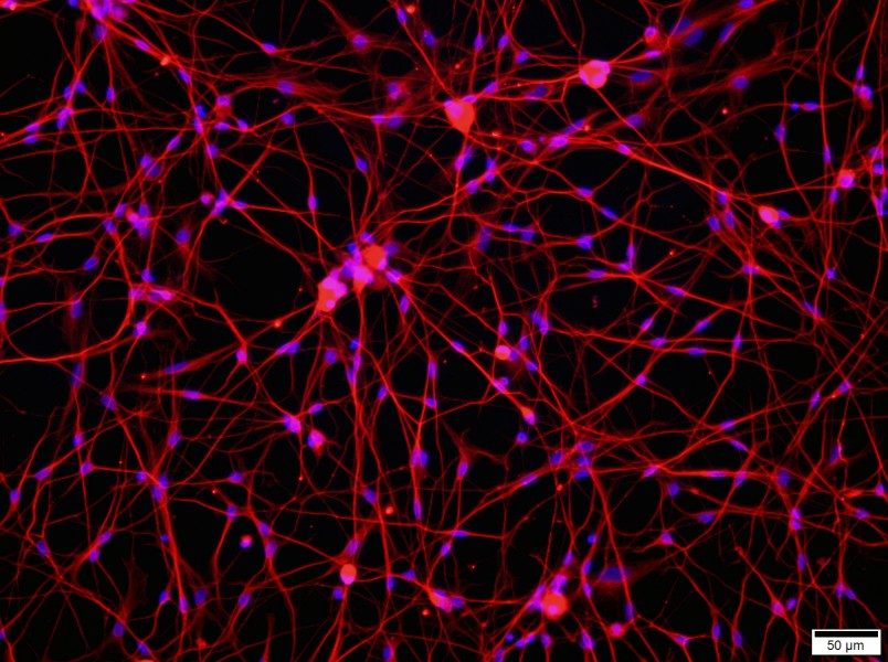 Rat Dorsal Root Neuron Complete Medium - 2
