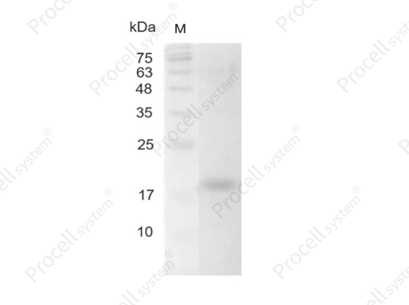 IL-16/LCF, Human, Recombinant