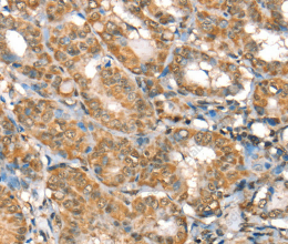 RBM5 Polyclonal Antibody - 3