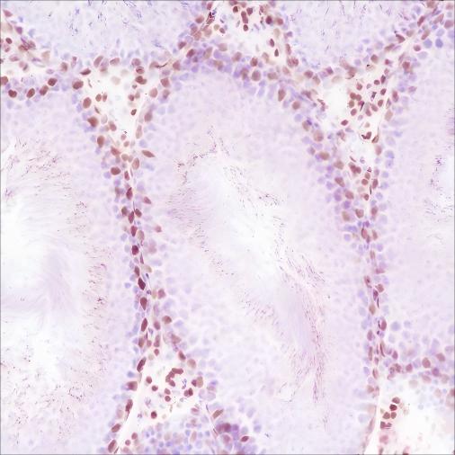 Recombinant Androgen Receptor (CT) Monoclonal Antibody - small - 5